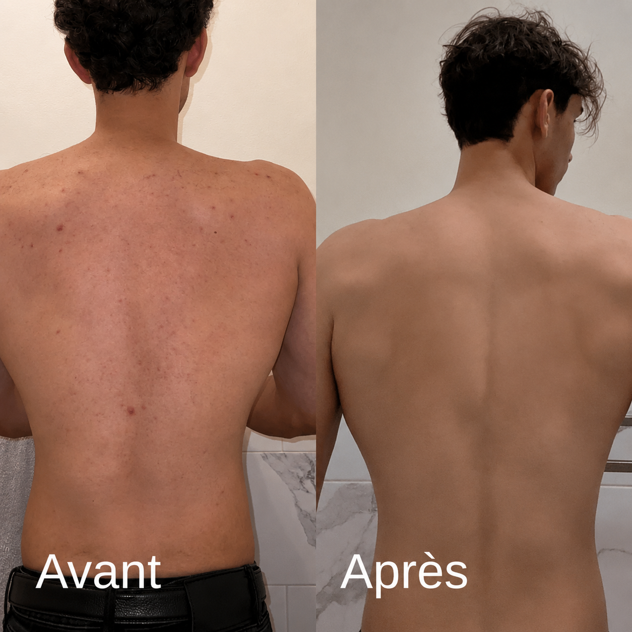 Image avant et après