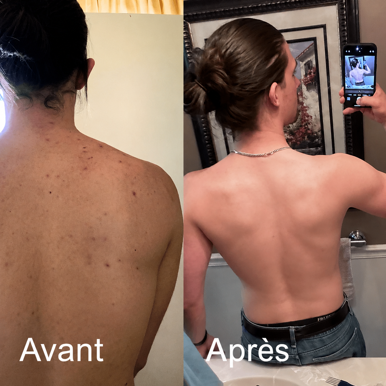Résultats avant et après
